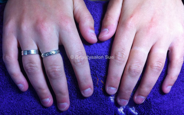 Beautysalon Sue – Nagelbijt